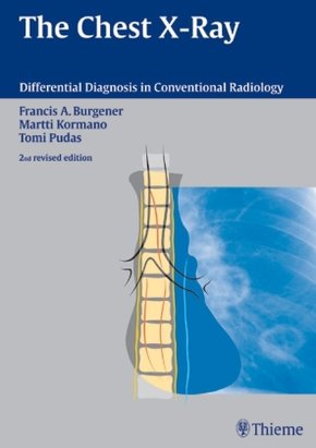 The Chest X-Rays