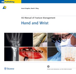 AO Manual of Fracture Management Hand and Wrist, with CD-ROM