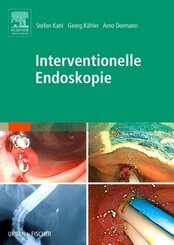 Interventionelle Endoskopie