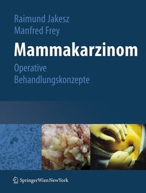 Mammakarzinom