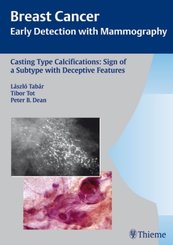 Breast Cancer: Casting Type Calcifications: Sign of a Subtype with Deceptive Features