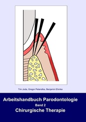 Arbeitshandbuch Parodontologie: Arbeitshandbuch Parodontologie