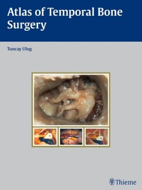 Atlas of Temporal Bone Surgery