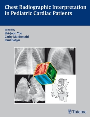 Chest Radiographic Interpretation in Pediatric Cardiac Patients