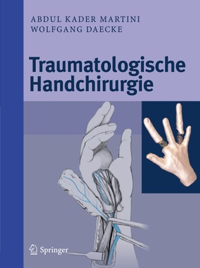 Traumatologische Handchirurgie