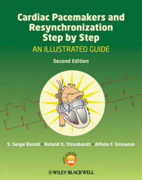 Cardiac Pacemakers and Resynchronization Therapy Step-by-Step