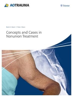 Concepts and Cases in Nonunion Treatment