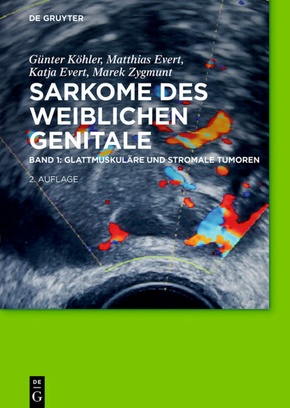 Sarkome des weiblichen Genitale: Glattmuskuläre und stromale Tumoren - Bd.1