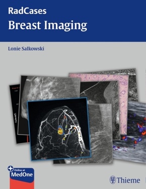 Radcases Breast Imaging