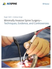 Minimally Invasive Spine Surgery - Techniques, Evidence, and Controversies