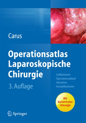 Operationsatlas Laparoskopische Chirurgie