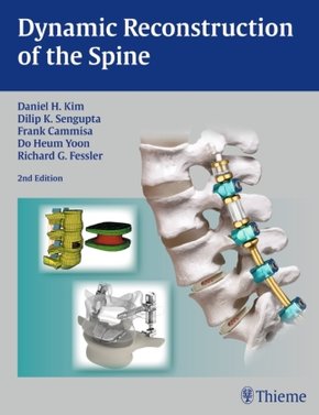 Dynamic Reconstruction of the Spine