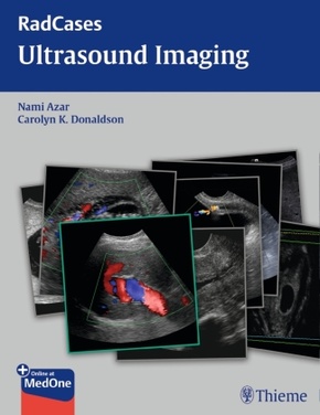 Radcases Ultrasound Imaging