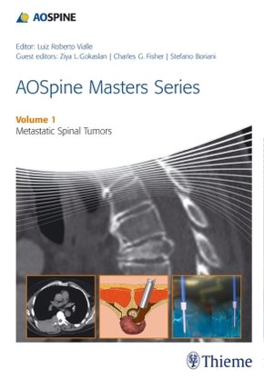 AO Spine Masters Series - Metastic Spinal Tumors