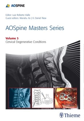 AOSpine Master Series - Cervical Degenerative Conditions