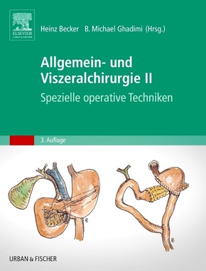 Allgemein- und Viszeralchirurgie - Bd.2