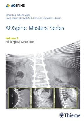 AOSpine Master Series - Adult Spinal Deformities