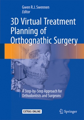 3D Virtual Treatment Planning of Orthognathic Surgery