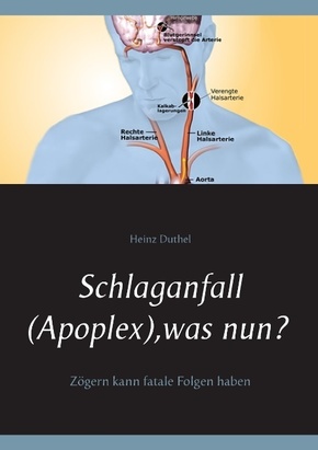 Schlaganfall (Apoplex), was nun?