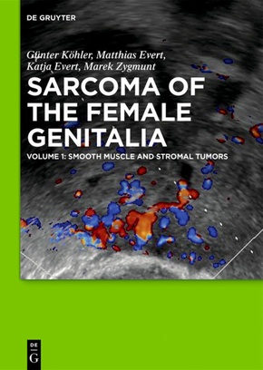 Sarcoma of the Female Genitalia: Smooth muscle and stromal tumors and prevention of inadequate surgery - Vol.1