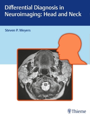 Differential Diagnosis in Neuroimaging: Head and Neck; .