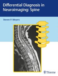 Differential Diagnosis in Neuroimaging: Spine; .