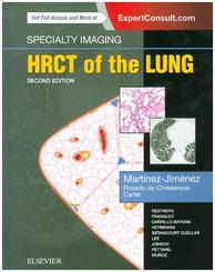 HRCT of the Lung