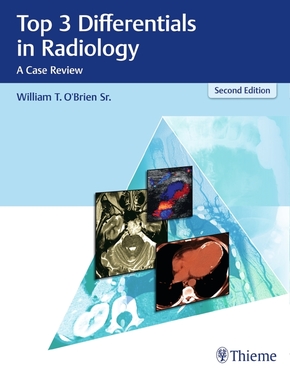 Top 3 Differentials in Radiology