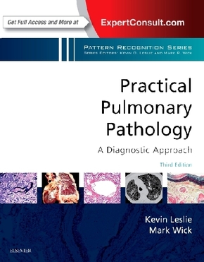 Practical Pulmonary Pathology: A Diagnostic Approach