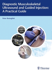 Diagnostic Musculoskeletal Ultrasound and Guided Injection: A Practical Guide; .