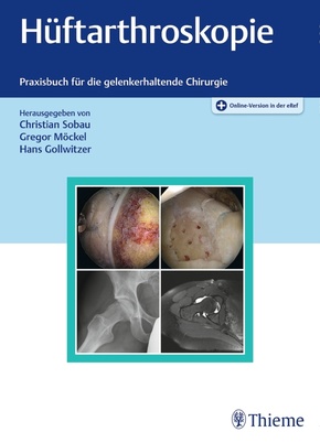 Hüftarthroskopie - Praxisbuch für die gelenkerhaltende Chirurgie