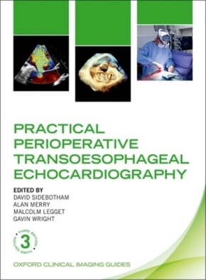 Practical Perioperative Transoesophageal Echocardiography