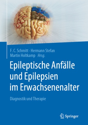 Epileptische Anfälle und Epilepsien im Erwachsenenalter