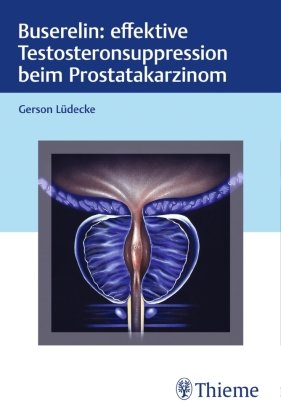 Buserelin: effektive Testosteronsuppression beim Prostatakarzinom