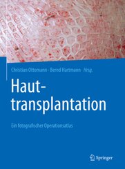 Hauttransplantation