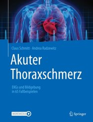 Akuter Thoraxschmerz