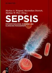 Sepsis