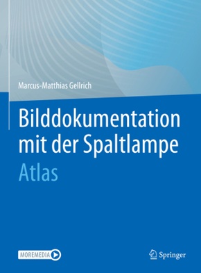 Bilddokumentation mit der Spaltlampe