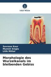 Morphologie des Wurzelkanals im bleibenden Gebiss