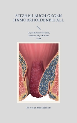 Sitzheilbuch gegen Hämorrhoidenbefall