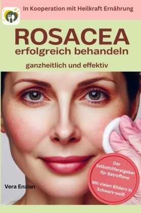 Rosacea erfolgreich behandeln - ganzheitlich und effektiv: Der Selbsthilferatgeber für Betroffene mit Tipps, die wirklic