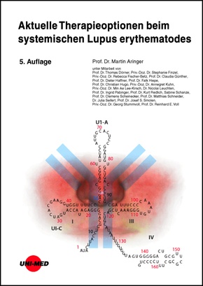 Aktuelle Therapieoptionen beim systemischen Lupus erythematodes