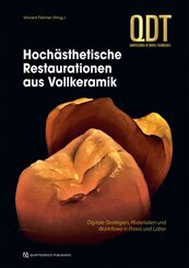 Hoch&auml;sthetische Restaurationen aus Vollkeramik