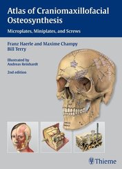 Atlas of Craniomaxillofacial Osteosynthesis