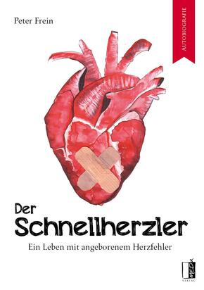 Der Schnellherzler
