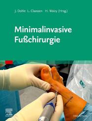 Minimalinvasive Fu&szlig;chirurgie