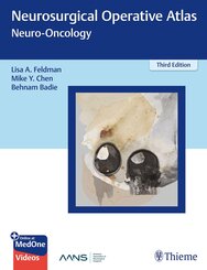 Neurosurgical Operative Atlas: Neuro-Oncology