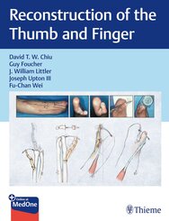 Reconstruction of the Thumb and Finger