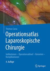 Operationsatlas Laparoskopische Chirurgie