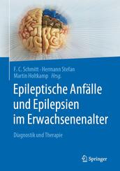 Epileptische Anf&auml;lle und Epilepsien im Erwachsenenalter
